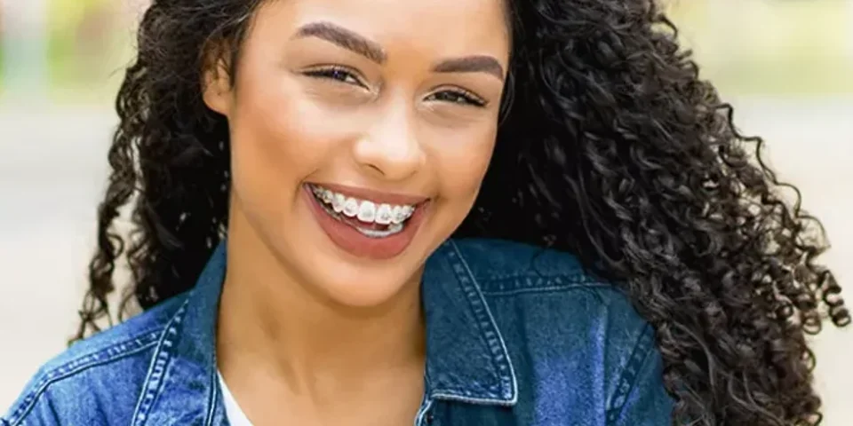 Braces for a Great Smile website homepage